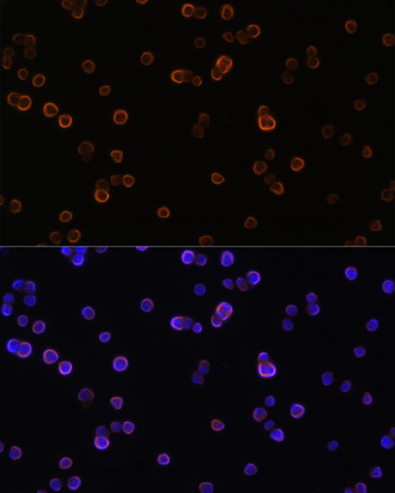 Anti-PLCG2 Rabbit pAb
