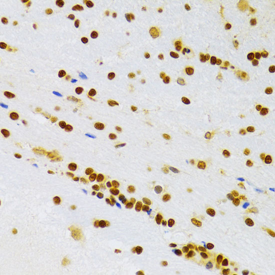 Anti-HMGB1 Rabbit pAb
