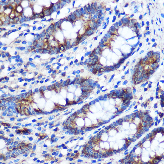 Anti-STAT4 Rabbit pAb