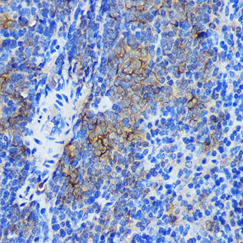 Anti-STAT4 Rabbit pAb