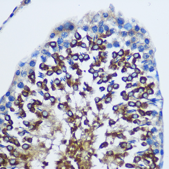 Anti-STAT4 Rabbit pAb