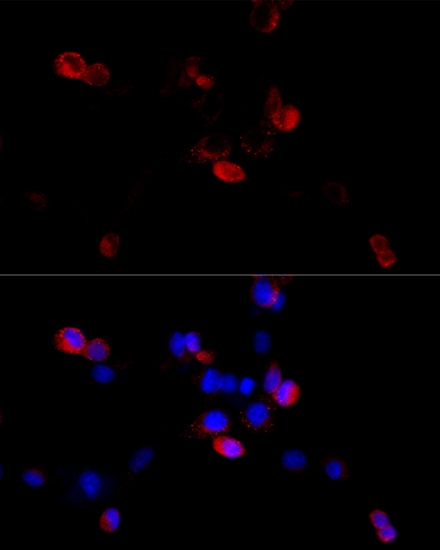 Anti-Filamin B Rabbit pAb
