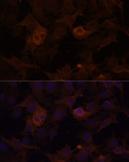 Anti-Filamin B Rabbit pAb