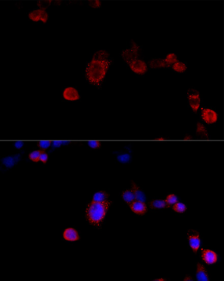 Anti-Filamin B Rabbit pAb