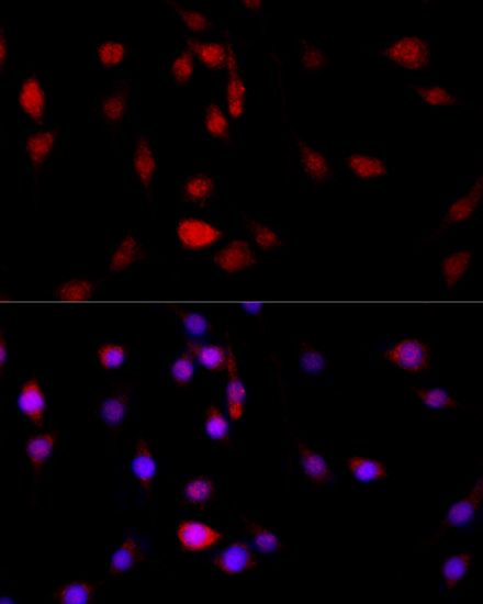 Anti-Filamin B Rabbit pAb