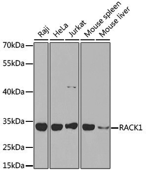 Anti-RACK1 Rabbit pAb