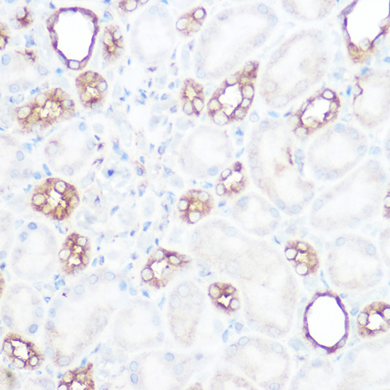 Anti-Calpain 2 Rabbit pAb