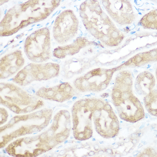 Anti-Calpain 2 Rabbit pAb