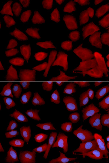 Anti-Tbp7 Rabbit pAb