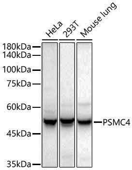 Anti-Tbp7 Rabbit pAb