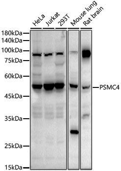 Anti-Tbp7 Rabbit pAb