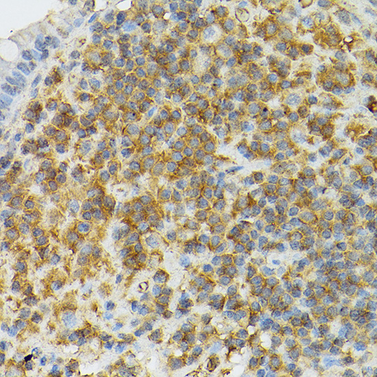 Anti-CD25 Rabbit pAb