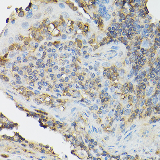 Anti-CD25 Rabbit pAb