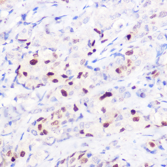 Anti-p21 Rabbit pAb