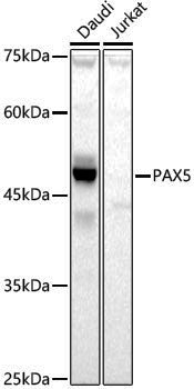 Anti-PAX5 Rabbit pAb