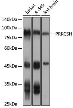 Anti-GLU2B Rabbit pAb