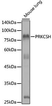Anti-GLU2B Rabbit pAb