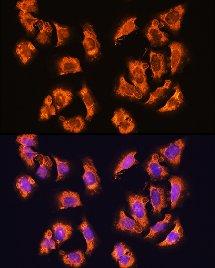 Anti-alpha Sarcoglycan Rabbit pAb