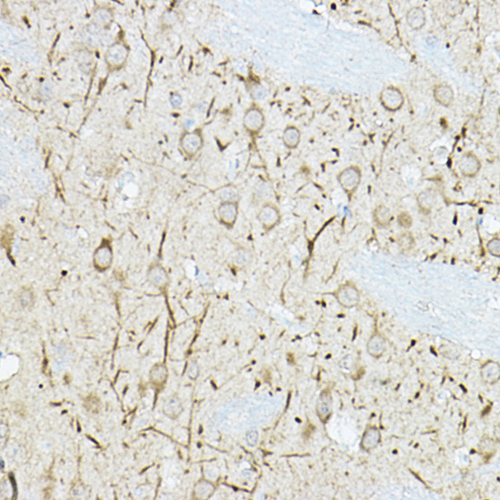 Anti-DUSP6 Rabbit pAb