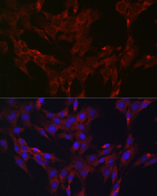 Anti-DUSP6 Rabbit pAb