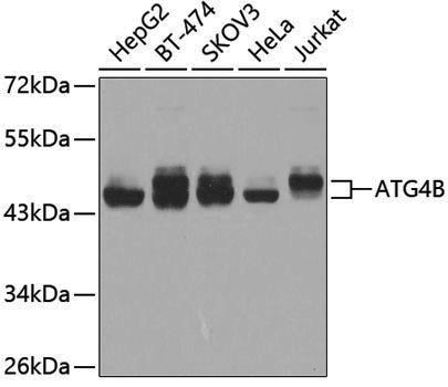 Anti-ATG4B Rabbit pAb