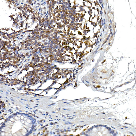 Anti-NFATC2 Rabbit pAb