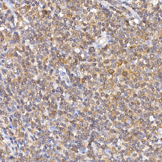 Anti-NFATC2 Rabbit pAb