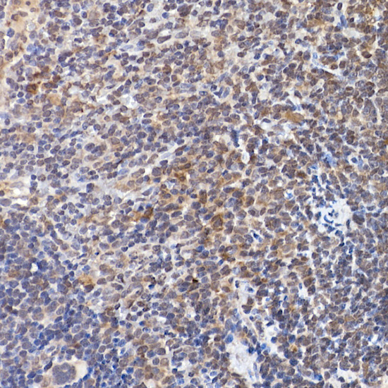 Anti-NFATC2 Rabbit pAb
