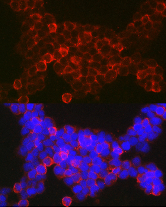 Anti-NFATC2 Rabbit pAb