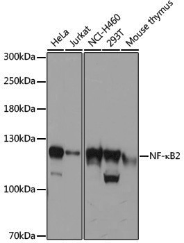 Anti-NF-KB p100 Rabbit pAb