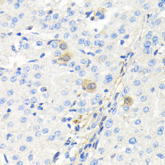 Anti-Thymidine Kinase Rabbit pAb