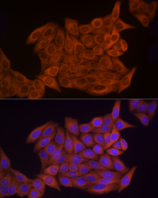Anti-Thymidine Kinase Rabbit pAb