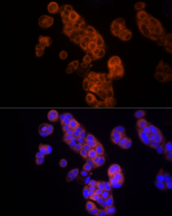 Anti-Thymidine Kinase Rabbit pAb
