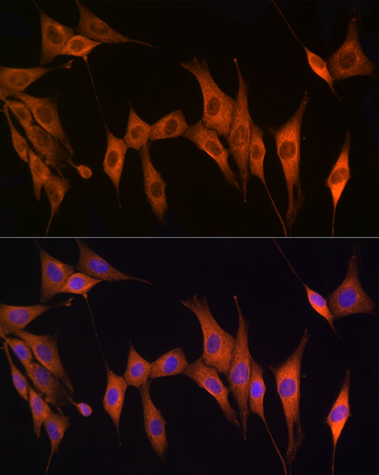 Anti-Thymidine Kinase Rabbit pAb