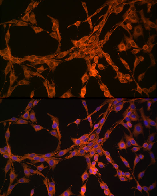 Anti-Thymidine Kinase Rabbit pAb