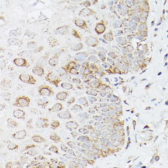 Anti-Glutamine Synthetase Rabbit pAb