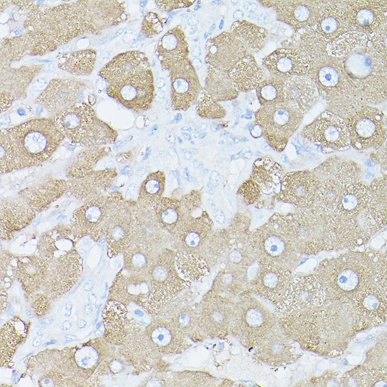 Anti-Glutamine Synthetase Rabbit pAb