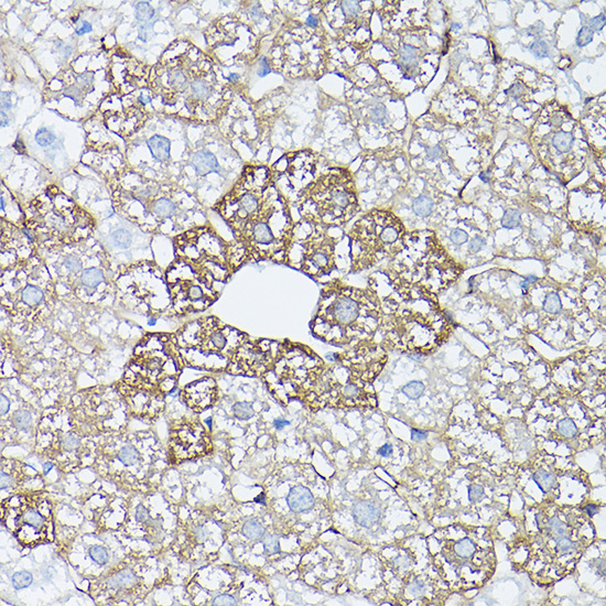 Anti-Glutamine Synthetase Rabbit pAb