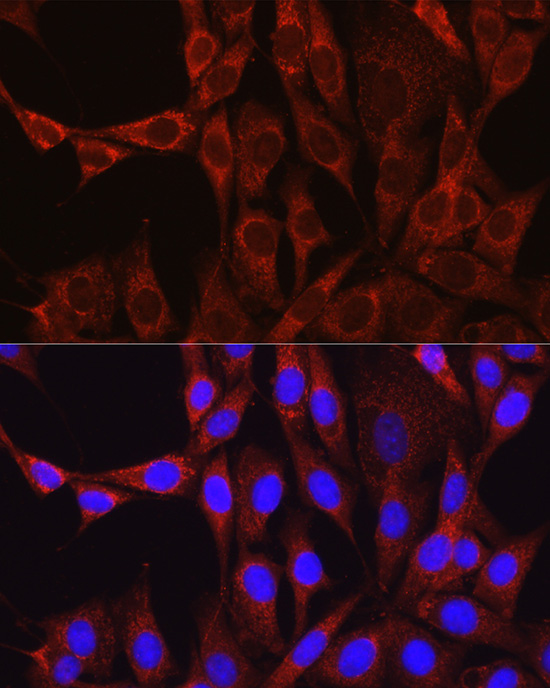 Anti-Glutamine Synthetase Rabbit pAb