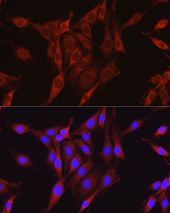 Anti-Glutamine Synthetase Rabbit pAb