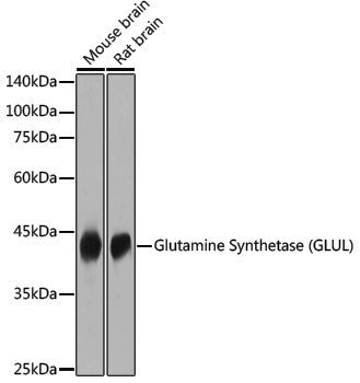 Anti-Glutamine Synthetase Rabbit pAb