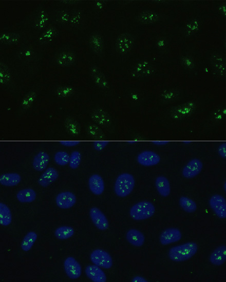 Anti-NOLC1 Rabbit pAb