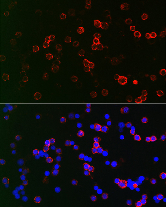 Anti-CD22 Rabbit pAb