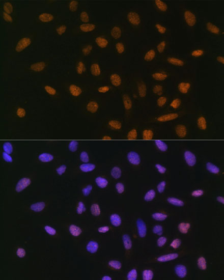 Anti-SNAI1 Rabbit pAb