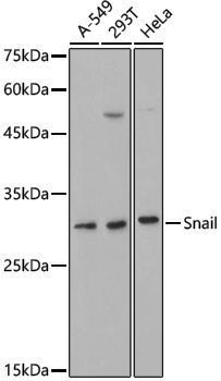 Anti-SNAI1 Rabbit pAb