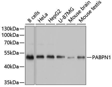 Anti-PABPN1 Rabbit pAb