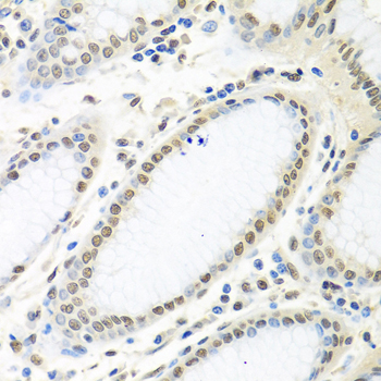 [KO Validated] Anti-HuR/ELAVL1 Rabbit pAb