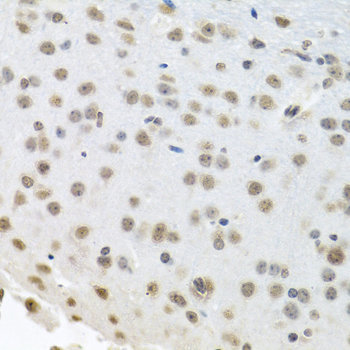 [KO Validated] Anti-HuR/ELAVL1 Rabbit pAb