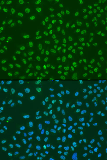 [KO Validated] Anti-HuR/ELAVL1 Rabbit pAb