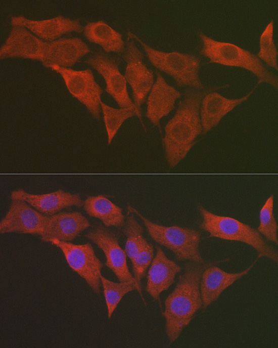 Anti-RPS6 Rabbit pAb